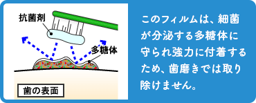 歯ブラシで取り除くことは不可能